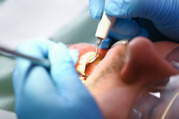 Best Cracked Tooth Emergency Dentist  in North Randall, OH